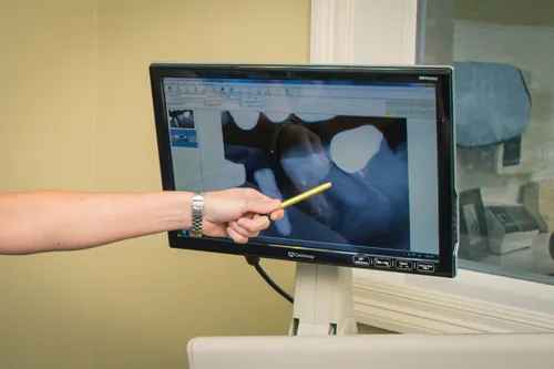 A dentist pointing to a dental X-ray on a chair-side screen